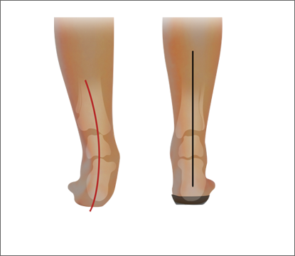 FLOPEDS TAF